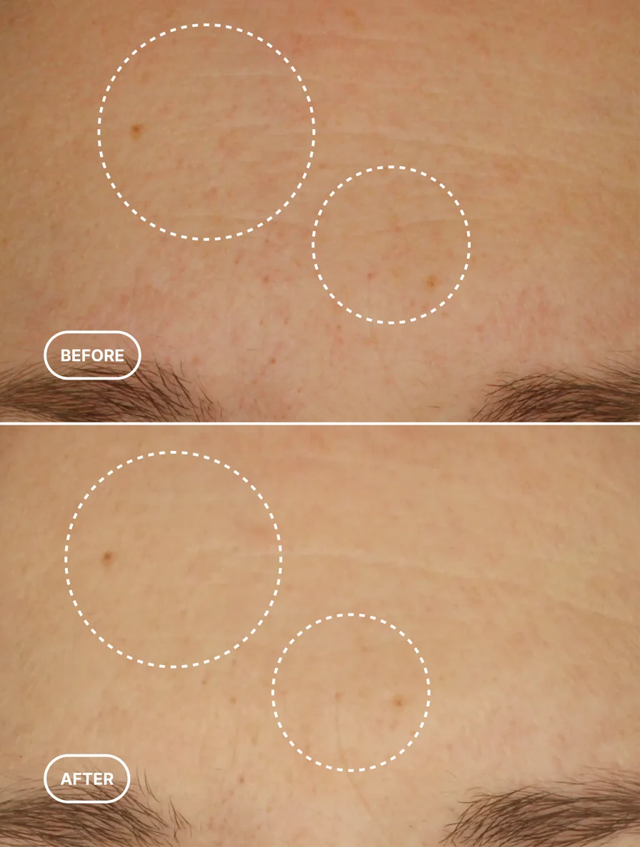 Sérum Alternativo al Retinol (Textura Acuosa)